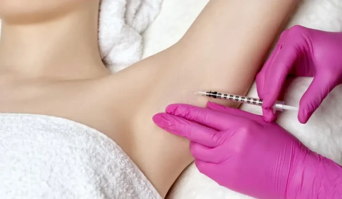 botox protiv znojenja botoks protiv znojenja