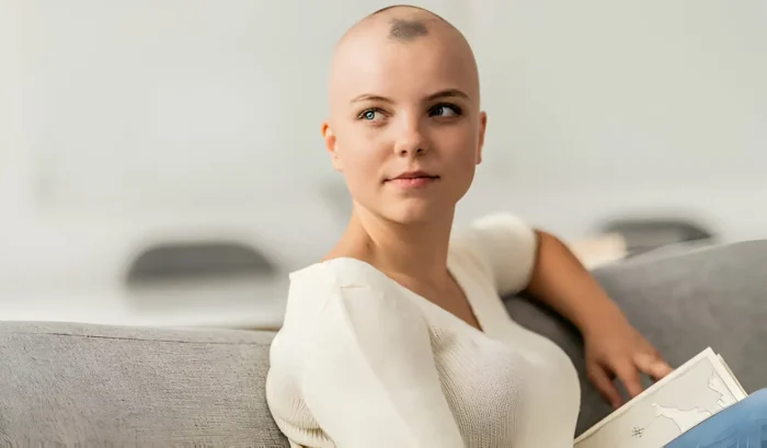 alopecija lijek za alopeciju