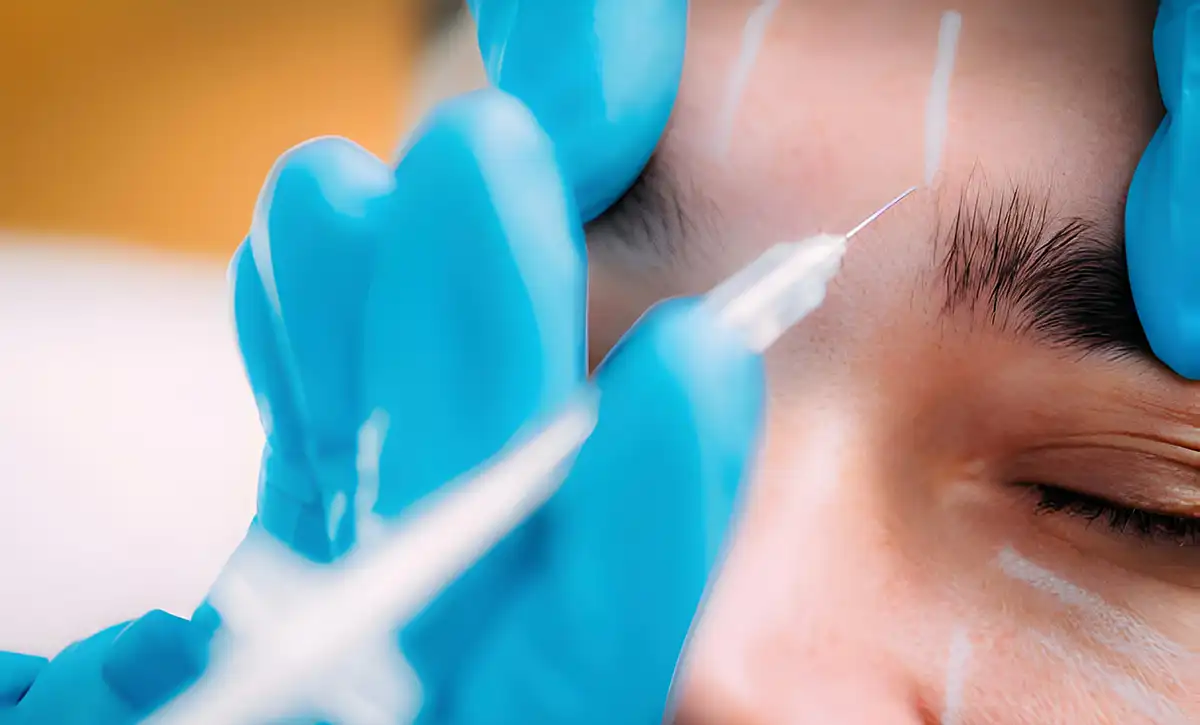 Elevacija elegancije: Transformacija lica podizanjem čela u Beogradu ...