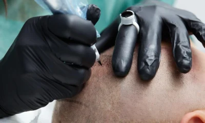 The Reality Behind Hair Transplant Side Effects: Are You Fully Prepared?