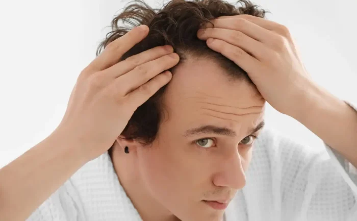 How to know if a hair transplant is successful