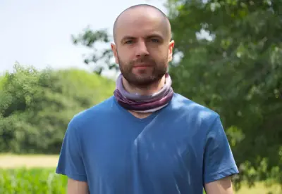 Istanbul Hair Transplant Packages: I Traded My Hairline for Turkish Hospitality