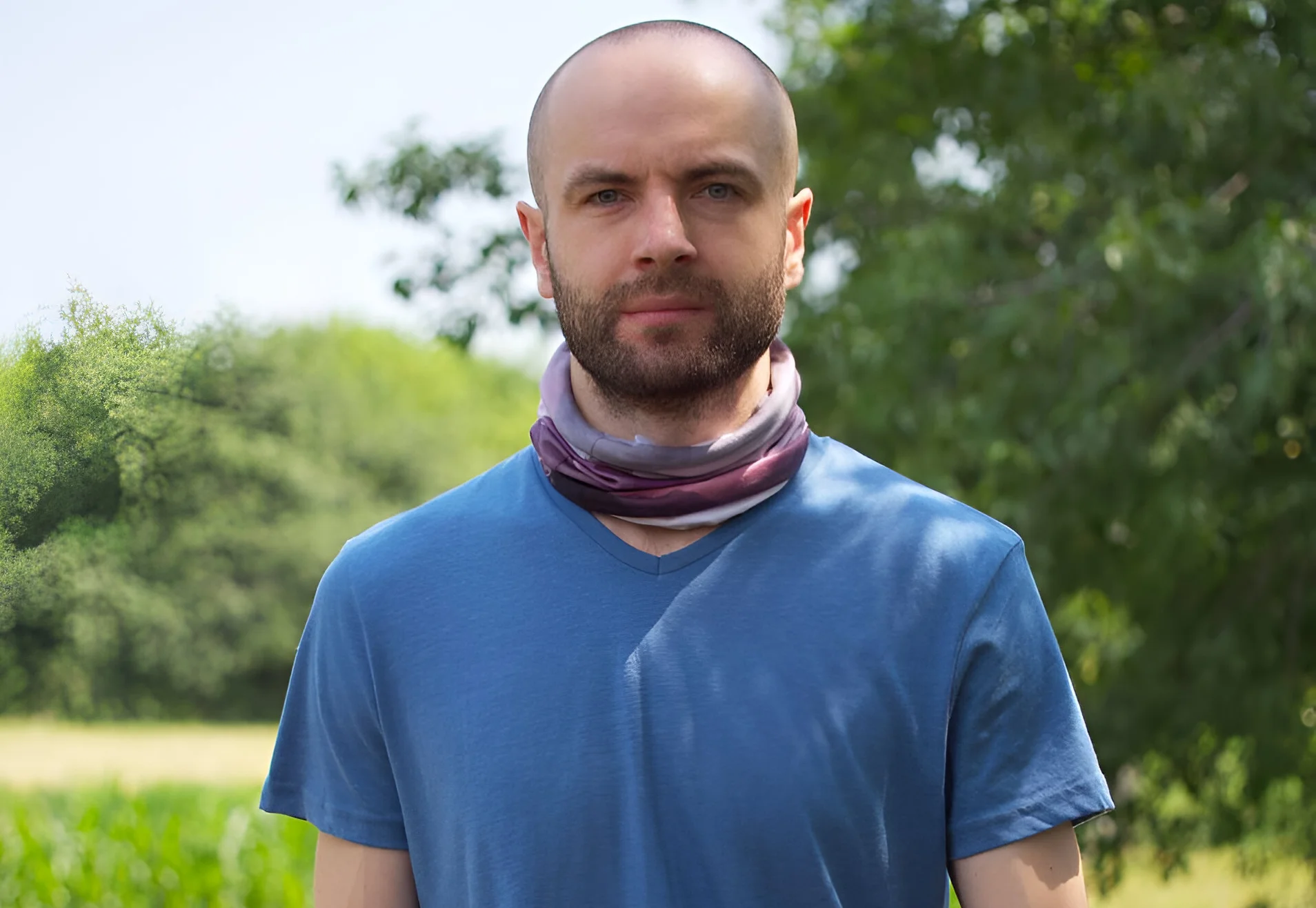 Istanbul Hair Transplant Packages: I Traded My Hairline for Turkish Hospitality